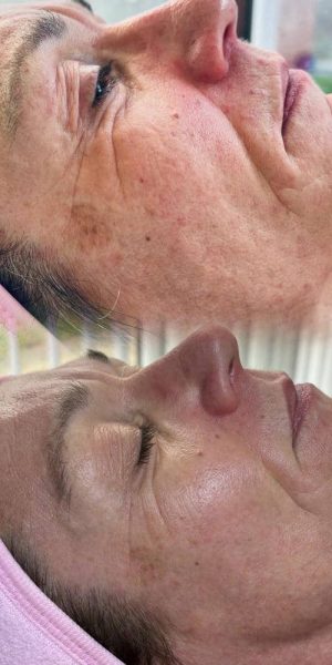 c95010e8-4c94-4b44-ba87-2ab97be944a51080