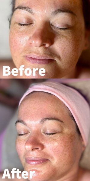 facial facial